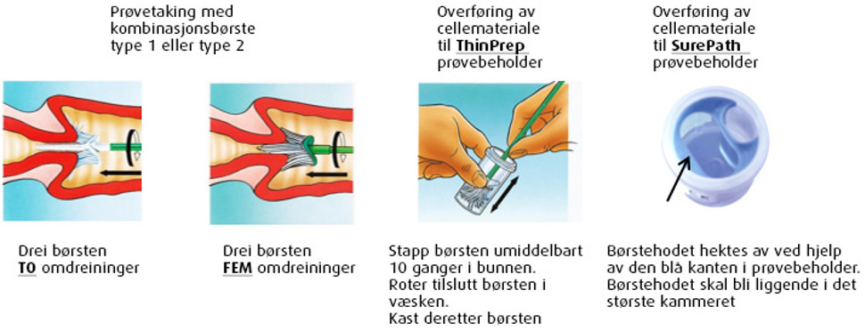 Prøvetaking av livmnorhals med kombinasjonsbørste