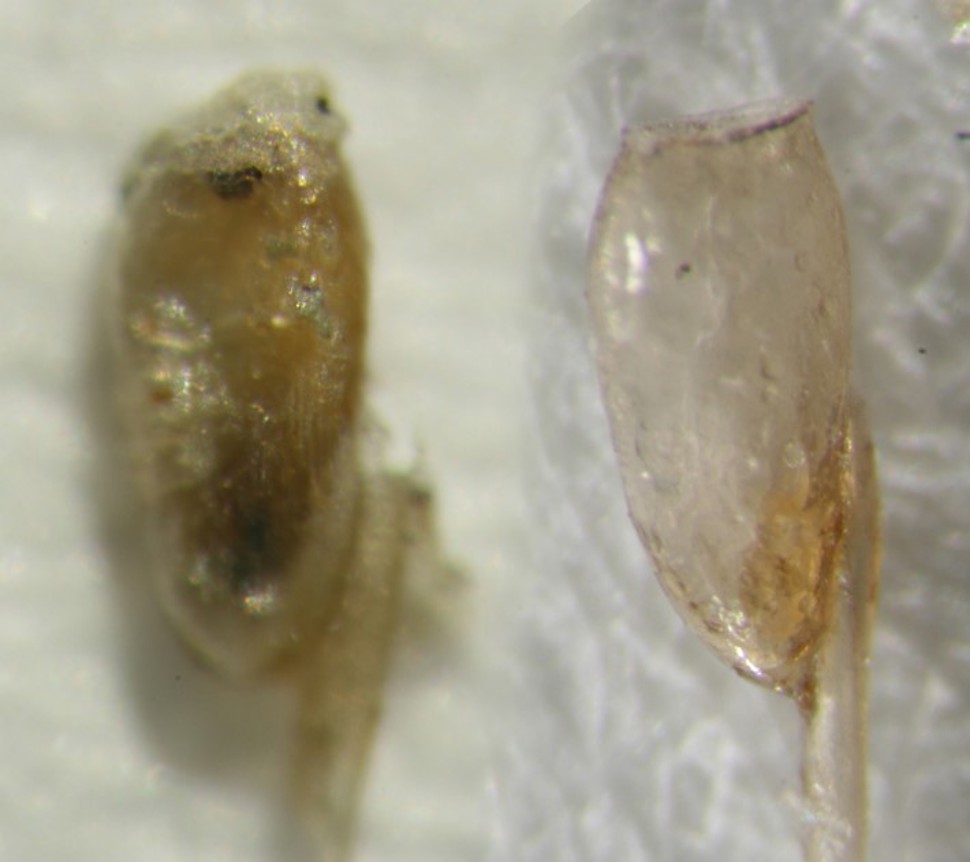 Egg av hodelus med og uten embryo
