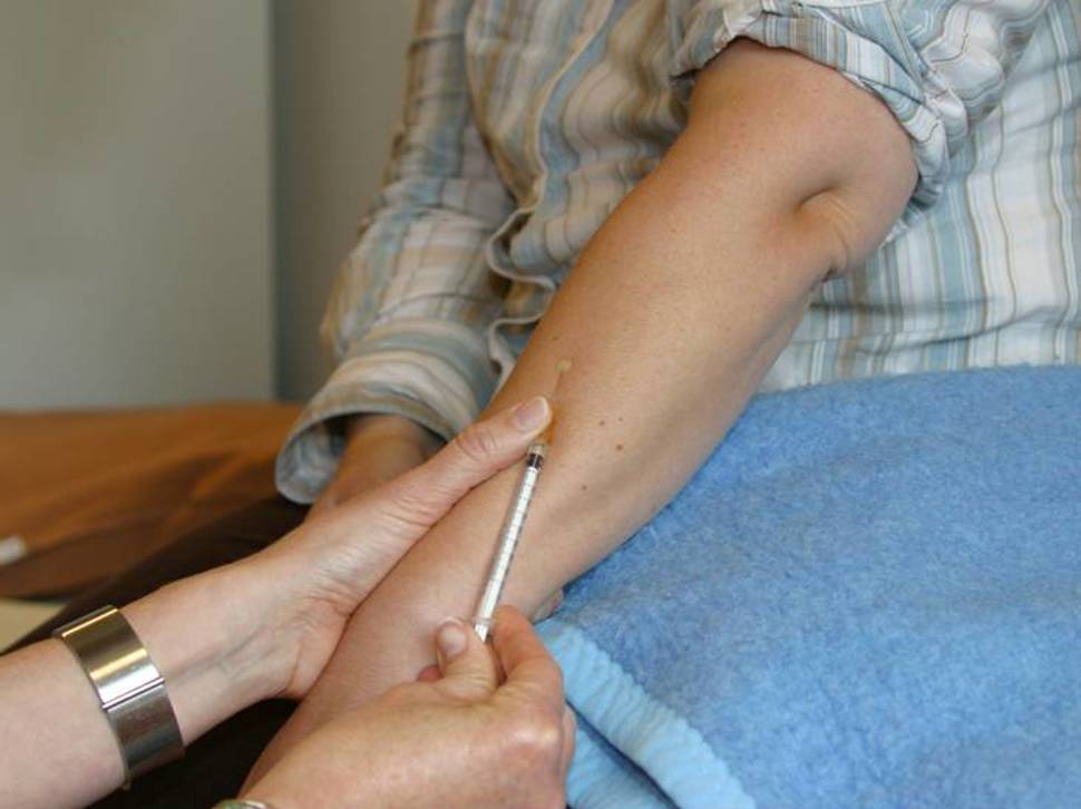 Mantoux_2.jpg