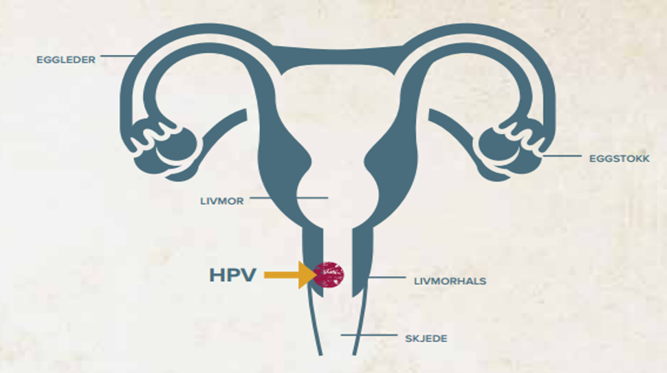 Livmorhals